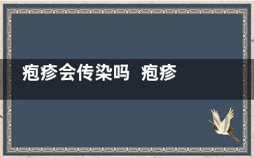疱疹会传染吗  疱疹会出现传染吗